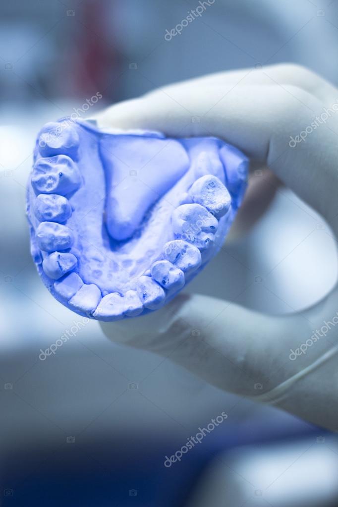 Dental mold dentist clay teeth ceramic plate model cast Stock Photo by  ©edwardolive 75673999
